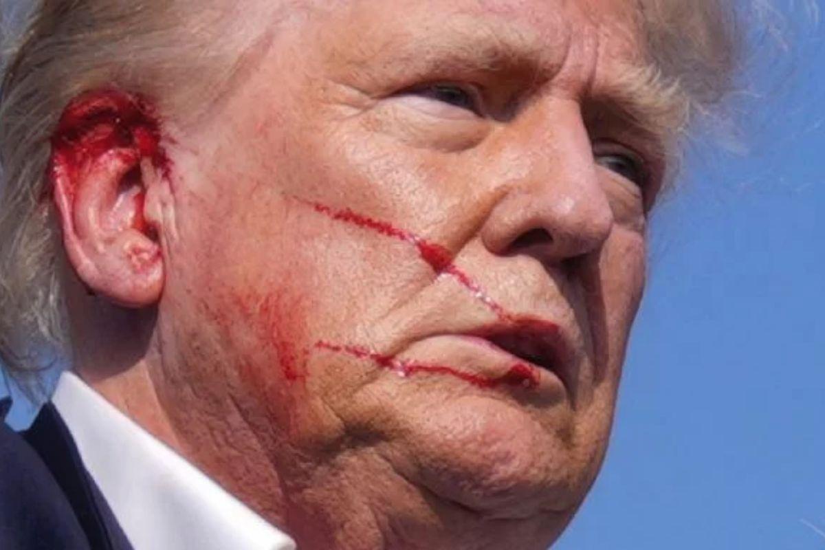 DONALD TRUM, Presultó herido.